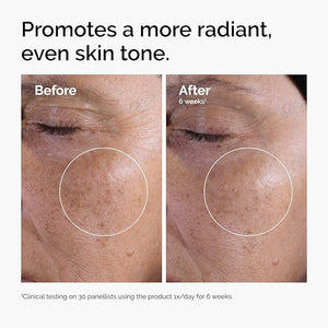 Before and after comparison of skin texture with text indicating product's effect on skin tone.