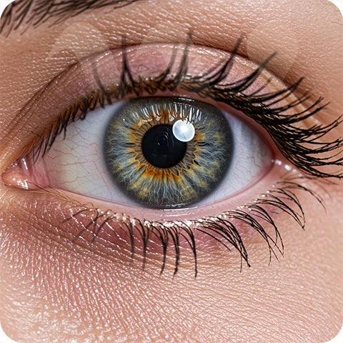 Contact Lenses